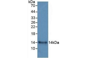 Detection of Recombinant IL33, Human using Monoclonal Antibody to Interleukin 33 (IL33) (IL-33 抗体  (AA 112-270))