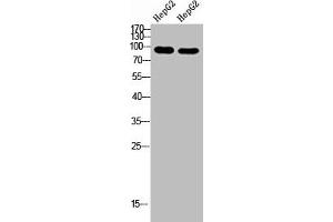 Western Blot analysis of hepg2 cells using Antibody diluted at 1000. (CACTIN 抗体  (AA 141-190))