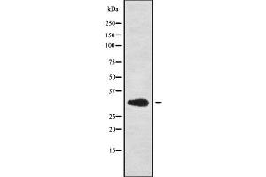 Western blot analysis OTUB1 using HuvEc whole cell lysates (OTUB1 抗体  (Internal Region))