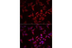 Immunofluorescence analysis of U2OS cells using NCR3 antibody.