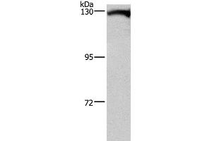 Western Blot analysis of Human testis tissue using DAAM1 Polyclonal Antibody at dilution of 1:400 (DAAM1 抗体)