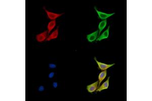 ABIN7096683 and ABIN7100748 staining HepG2 cells by IF/ICC. (PIGK 抗体)