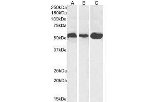 Western Blot using anti-Alpha-Tubulin antibody F2C. (Recombinant alpha Tubulin 抗体)