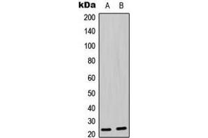 Western blot analysis of BAD (pS136) expression in MOLT4 (A), U2OS (B) whole cell lysates. (BAD 抗体  (pSer136))