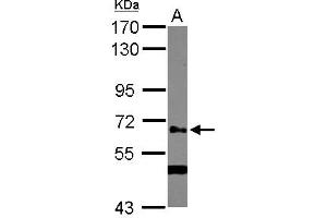 Western Blotting (WB) image for anti-UDP-N-Acetyl-alpha-D-Galactosamine:polypeptide N-Acetylgalactosaminyltransferase 14 (GalNAc-T14) (GALNT14) (AA 1-189) antibody (ABIN1498369) (GALNT14 抗体  (AA 1-189))
