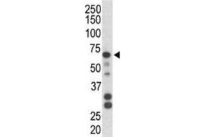 Western Blotting (WB) image for anti-Parkinson Protein 2, E3 Ubiquitin Protein Ligase (Parkin) (PARK2) antibody (ABIN3002636) (Parkin 抗体)