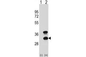 Western blot analysis of CD79b antibody and 293 cell lysate (2 ug/lane) either nontransfected (Lane 1) or transiently transfected (2) with the CD79B gene. (CD79b 抗体  (AA 93-121))