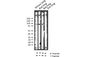 Western Blotting (WB) image for anti-Vav 1 Oncogene (VAV1) (pTyr174) antibody (ABIN6256653)