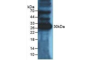 Detection of PDL1 in Mouse Heart Tissue using Polyclonal Antibody to Programmed Cell Death Protein 1 Ligand 1 (PDL1) (PD-L1 抗体  (AA 48-290))
