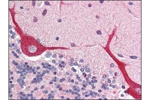 Image no. 1 for anti-Interleukin 23, alpha subunit p19 (IL23A) (N-Term) antibody (ABIN303269) (IL23A 抗体  (N-Term))