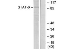 Western Blotting (WB) image for anti-Signal Transducer and Activator of Transcription 6, Interleukin-4 Induced (STAT6) (AA 612-661) antibody (ABIN2889070) (STAT6 抗体  (AA 612-661))