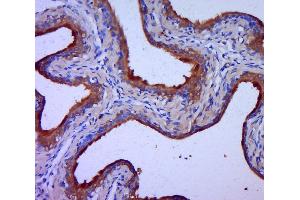 Paraformaldehyde-fixed, paraffin embedded rat bladder, Antigen retrieval by boiling in sodium citrate buffer (pH6. (Claudin 1 抗体  (AA 121-211))