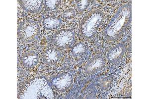 IHC analysis of PTRF/CAVIN1 using anti-PTRF/CAVIN1 antibody (ABIN7601817). (PTRF 抗体  (AA 47-390))