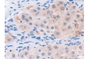 Immunohistochemistry (IHC) image for anti-Electron-Transfer-Flavoprotein, beta Polypeptide (ETFB) (AA 2-255) antibody (ABIN7440638)