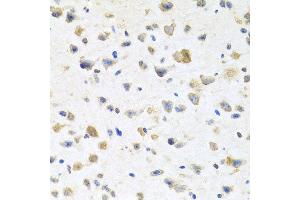 Immunohistochemistry of paraffin-embedded mouse brain using PGR antibody at dilution of 1:100 (x40 lens). (Progesterone Receptor 抗体)