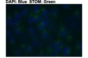 Immunofluorescent staining of HeLa cells with STOM polyclonal antibody  at 1:150 dilution. (Stomatin 抗体  (C-Term))