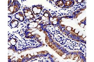 Immunohistochemistry analysis of paraffin-embedded rat colon using MMP2 Polyclonal Antibody at dilution of 1:500. (MMP2 抗体)