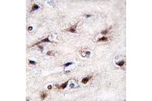 IHC analysis of FFPE human brain tissue stained with NURR1 antibody