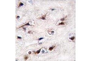IHC analysis of FFPE human brain tissue stained with NURR1 antibody (NR4A2 抗体  (AA 13-42))