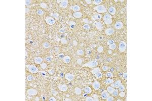 Immunohistochemistry of paraffin-embedded rat brain using SLC1A2 antibody (ABIN2736671) at dilution of 1:100 (40x lens). (SLC1A2 抗体)