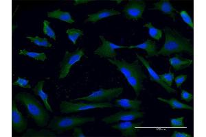 Immunofluorescence of monoclonal antibody to USP9X on HeLa cell. (USP9X 抗体  (AA 1-90))