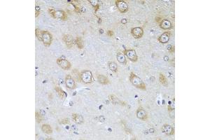 Immunohistochemistry of paraffin-embedded mouse brain using TMOD3 antibody. (TMOD3 抗体)