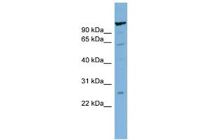 WB Suggested Anti-C6orf10 Antibody Titration:  0. (CDNA Sequence BC051142 (BC051142) (Middle Region) 抗体)
