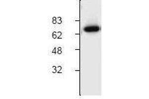 Image no. 1 for anti-Cholesteryl Ester Transfer Protein (CETP) (C-Term) antibody (ABIN127095) (CETP 抗体  (C-Term))