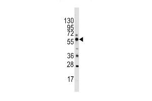 Western blot analysis of PIST Antibody (C-term) (ABIN391394 and ABIN2841398) in Ramos cell line lysates (35 μg/lane). (GOPC 抗体  (C-Term))