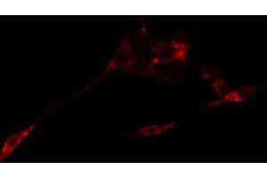 ABIN6274766 staining Hela cells by IF/ICC. (RPL10L 抗体  (C-Term))