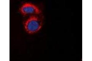Immunofluorescent analysis of mPR alpha staining in A549 cells. (PAQR7 抗体  (C-Term))