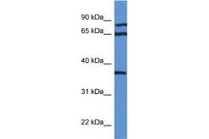 Image no. 1 for anti-Deoxyhypusine Synthase (DHPS) (AA 51-100) antibody (ABIN6746962) (DHPS 抗体  (AA 51-100))