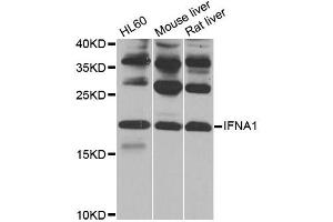 Western blot analysis of extracts of various cell lines, using IFNA1 antibody (ABIN1873146) at 1:1000 dilution. (IFNA1 抗体)