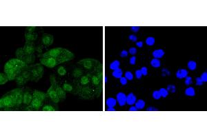 SW480 cells were stained with Cdk6 (4F7) Monoclonal Antibody  at [1:200] incubated overnight at 4C, followed by secondary antibody incubation, DAPI staining of the nuclei and detection. (CDK6 抗体)