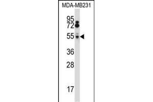 HTRA2 Antibody (N-term) (ABIN657628 and ABIN2846624) western blot analysis in MDA-M cell line lysates (35 μg/lane). (HTRA2 抗体  (N-Term))