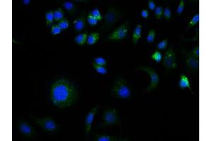 Immunofluorescence (Cultured Cells) (IF (cc)) image for anti-Glial Fibrillary Acidic Protein (GFAP) (AA 51-150) antibody (ABIN726200)