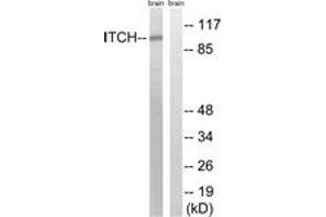 Western blot analysis of extracts from mouse brain cells, using ITCH (Ab-420) Antibody.