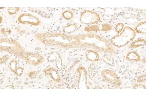 Detection of CDKN1A in Human Kidney Tissue using Polyclonal Antibody to Cyclin Dependent Kinase Inhibitor 1A (CDKN1A) (p21 抗体  (AA 1-164))