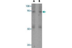 Western blot analysis of CD248 in human colon tissue lysate with CD248 polyclonal antibody  at (A) 0. (CD248 抗体  (N-Term))