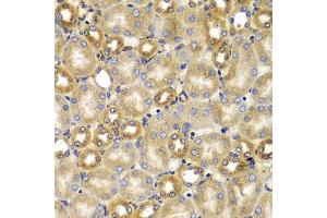 Immunohistochemistry of paraffin-embedded mouse kidney using SMAD9 antibody (ABIN5975592) at dilution of 1/100 (40x lens). (SMAD9 抗体)