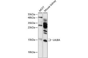 Western blot analysis of extracts of various cell lines, using LALBA antibody (ABIN6130518, ABIN6143065, ABIN6143066 and ABIN6216420) at 1:3000 dilution. (LALBA 抗体  (AA 20-142))