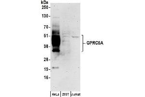 Western Blotting (WB) image for anti-G Protein-Coupled Receptor, Family C, Group 5, Member A (GPRC5A) (AA 307-357) antibody (ABIN7450301)