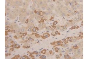 Detection of INHbC in Human Liver Tissue using Polyclonal Antibody to Inhibin Beta C (INHbC) (INHBC 抗体  (AA 236-352))