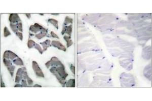 Immunohistochemistry (IHC) image for anti-Actin, gamma 2, Smooth Muscle, Enteric (ACTG2) (AA 1-50) antibody (ABIN1533207)