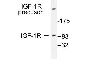 Image no. 1 for anti-Insulin-Like Growth Factor 1 Receptor (IGF1R) antibody (ABIN265475) (IGF1R 抗体)