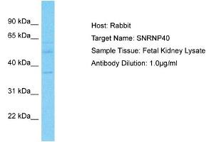 Host: Rabbit Target Name: SNRNP40 Sample Type: Fetal Kidney lysates Antibody Dilution: 1. (SNRNP40 抗体  (Middle Region))