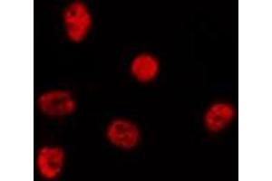 ABIN6278348 staining Hela by IF/ICC. (CHD5 抗体  (Internal Region))
