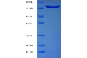 SDS-PAGE (SDS) image for Acyl-CoA Binding Domain Containing 5 (ACBD5) (AA 1-461), (partial) protein (His-SUMO Tag) (ABIN5711405) (ACBD5 Protein (AA 1-461, partial) (His-SUMO Tag))