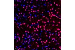 Immunofluorescence of paraffin embedded mouse kidney using ZNF106 (ABIN7076260) at dilution of 1:500 (400x lens) (ZFP106 抗体)