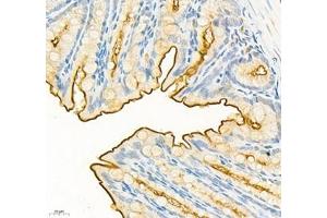 Immunohistochemistry of paraffin embedded mouse colon using CEACAM1 (ABIN7073315) at dilution of 1: 650 (400x lens) (CEACAM1 抗体)